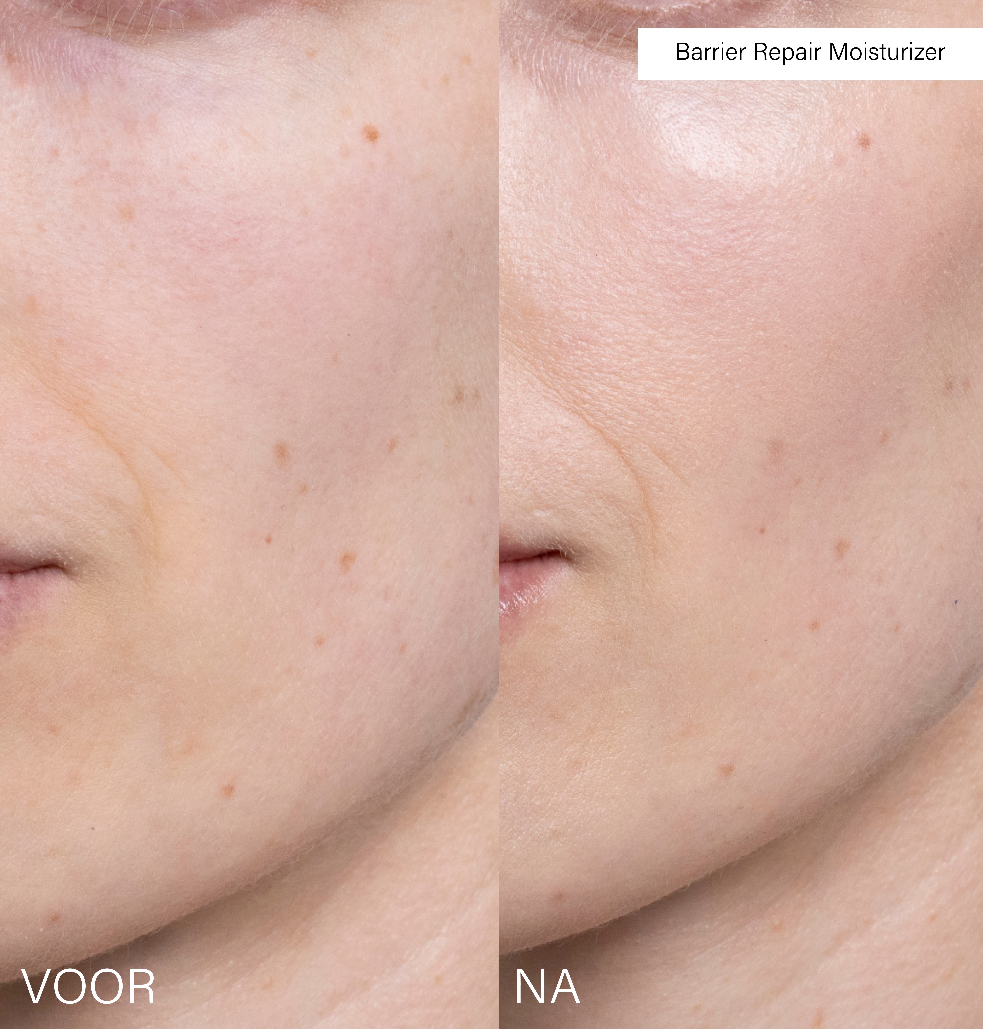 Barrier Repair Moisturizer