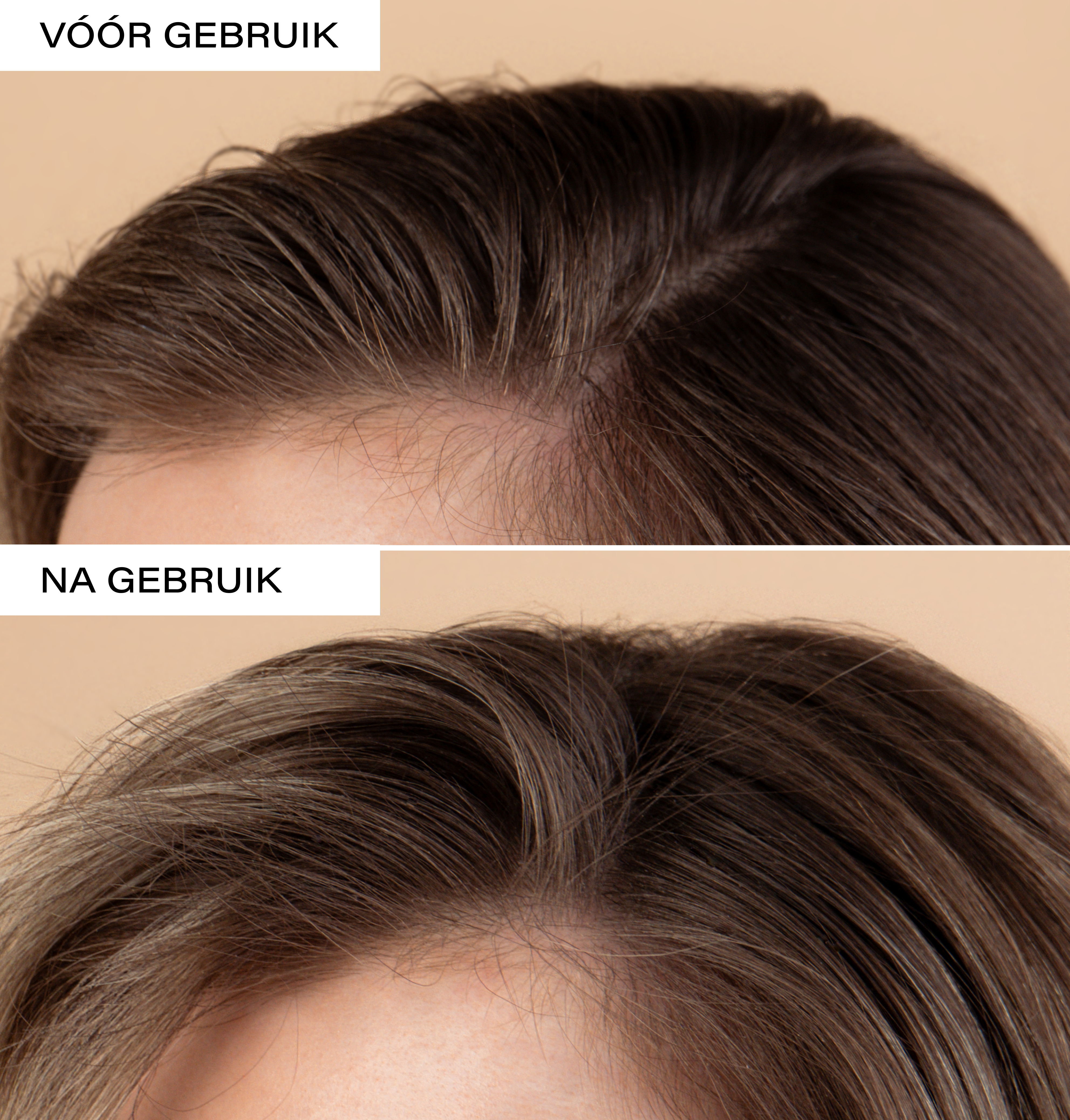 Natural Dry Shampoo | Refreshing and Volumizing