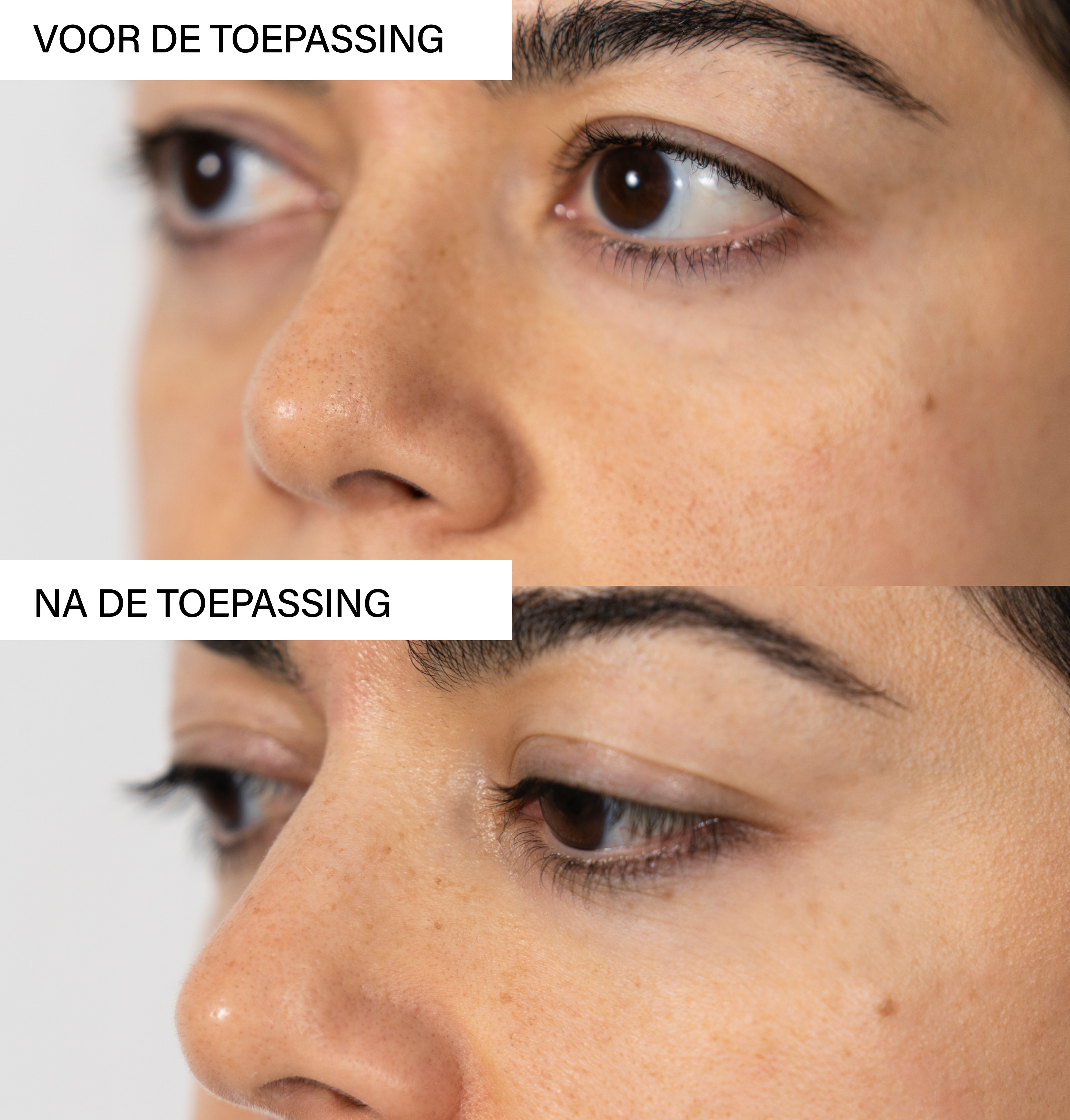 Anti-Breakout Exfoliating Set