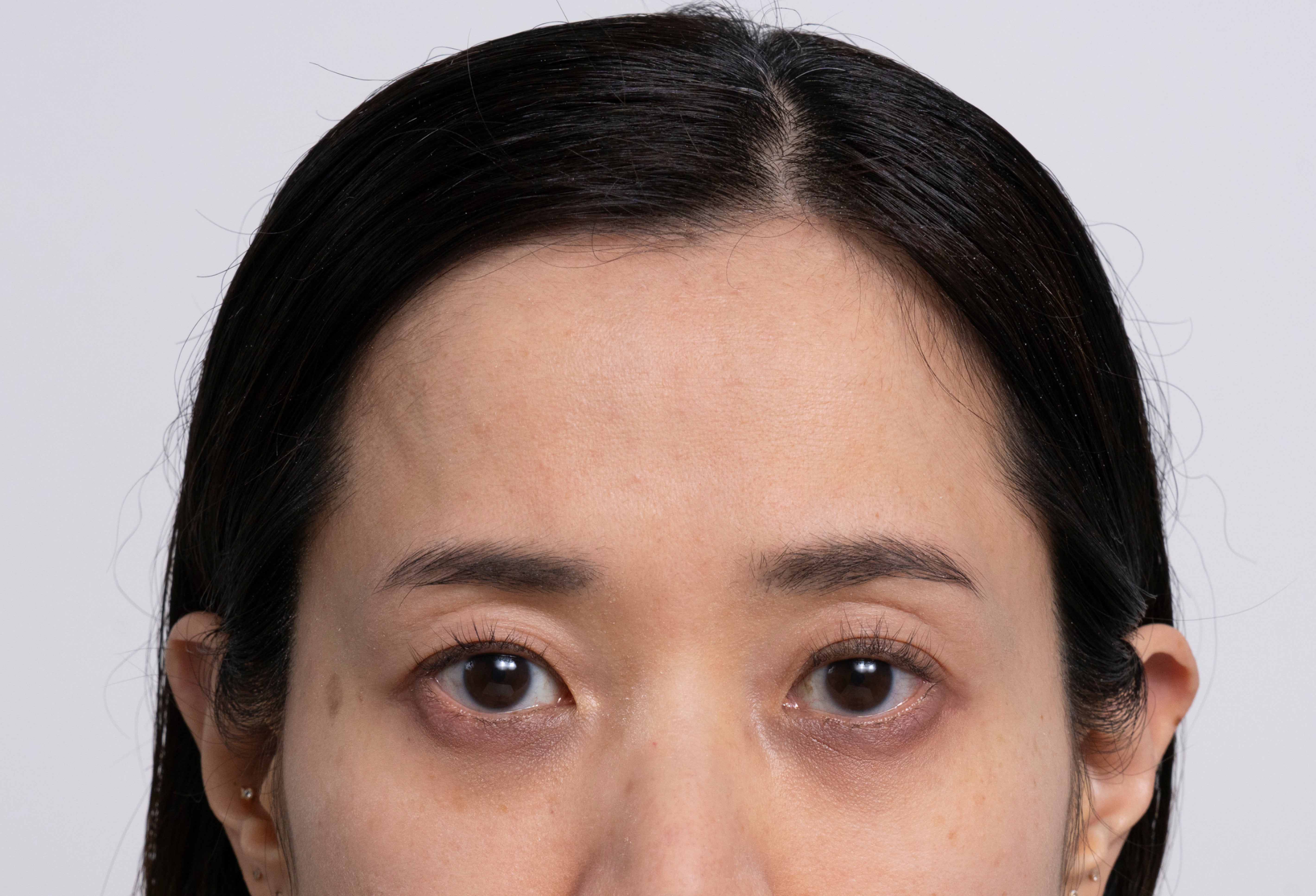 Gedeeltelijk portret van een vrouw met een glad voorhoofd, een heldere huid en lichte donkere kringen onder haar ogen.
