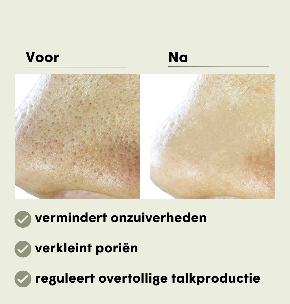 Avo Clay Mask Treatment NL | – Rosental Purifying