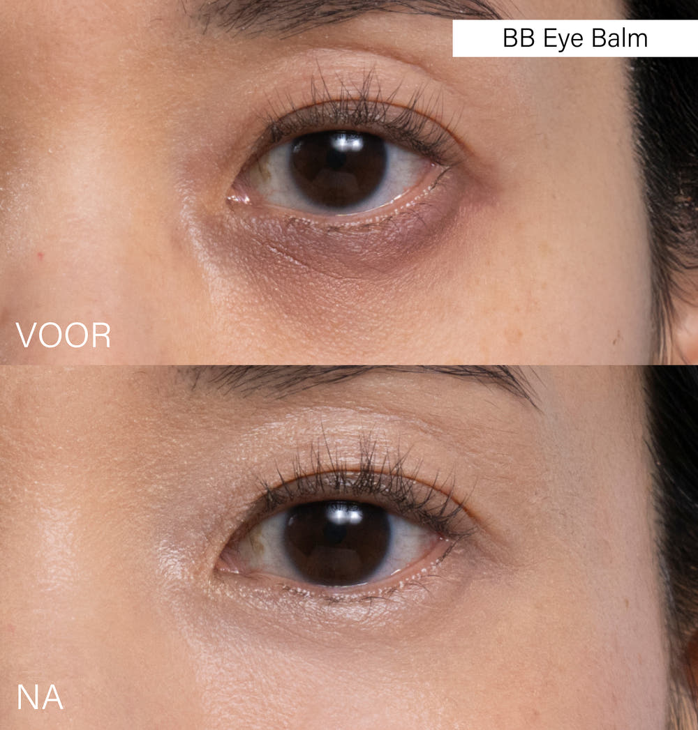 BB Eye Balm