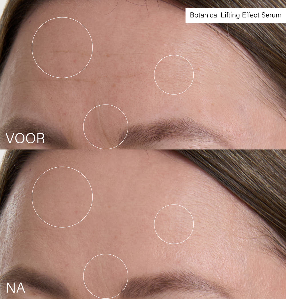 Botanical Lifting Effect Serum