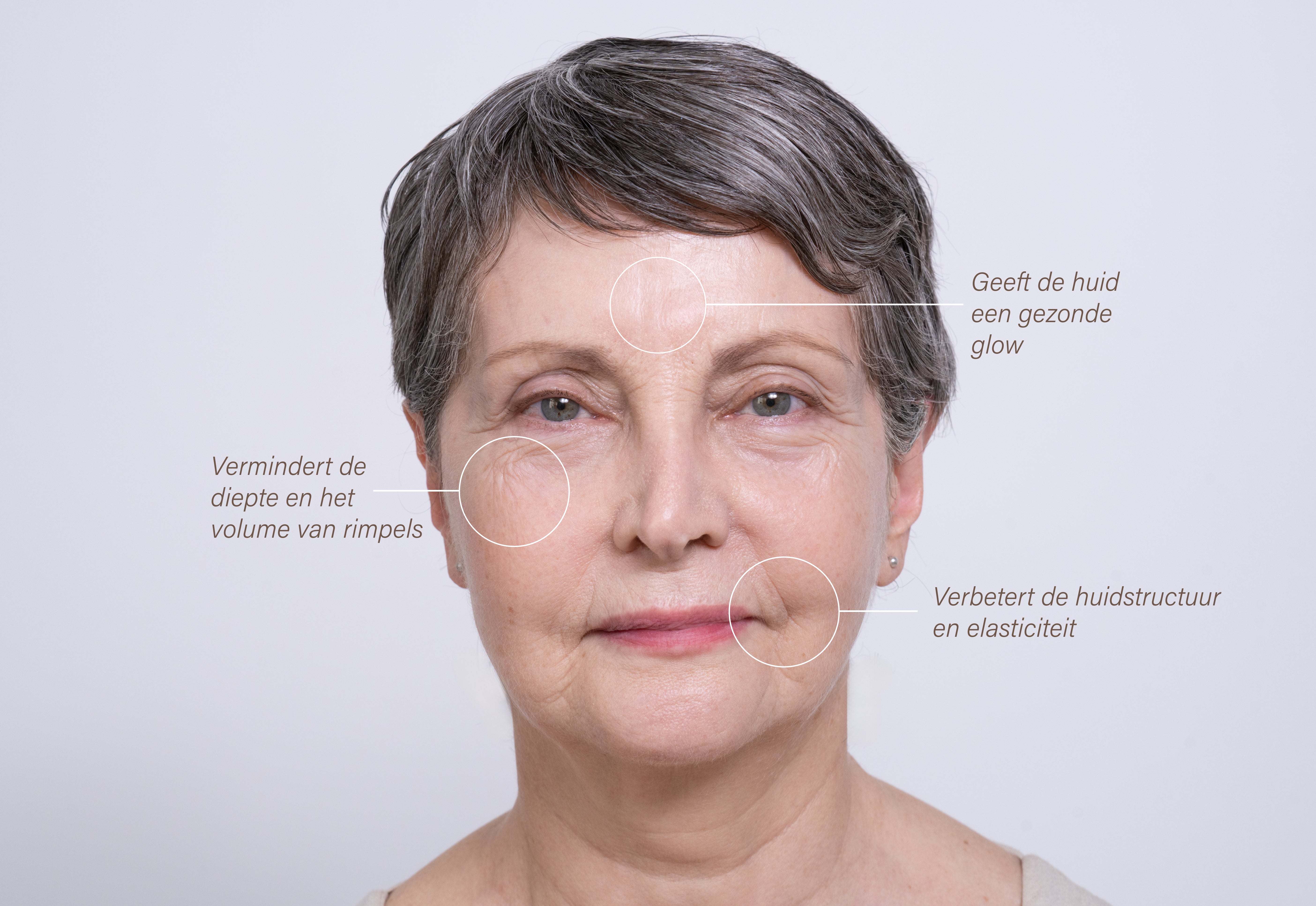 Portret van een oudere vrouw waarbij het voorhoofd, de ogen en de mond zijn gemarkeerd met een cirkel.