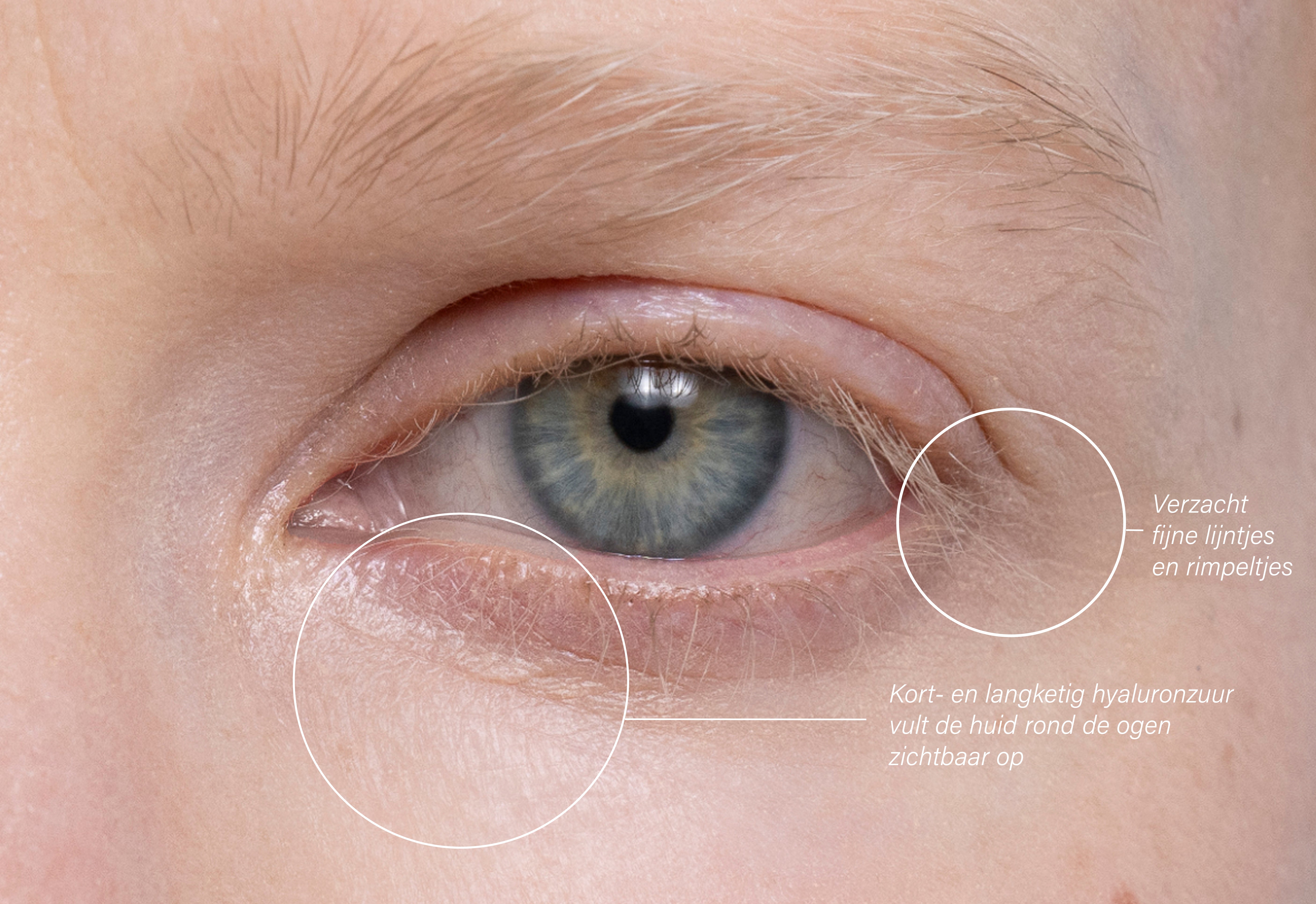 Close-up van een blauw oog met fijne, lichte wimpers en duidelijke rimpels.