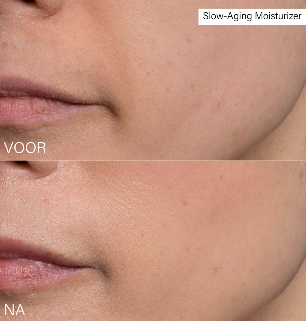 Slow-Aging Moisturizer