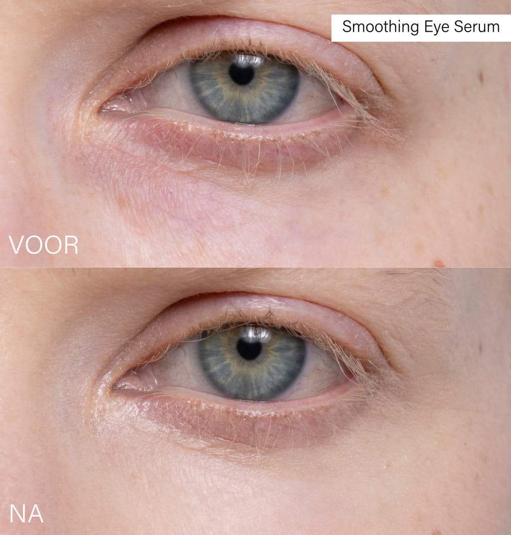 Smoothing Eye Serum