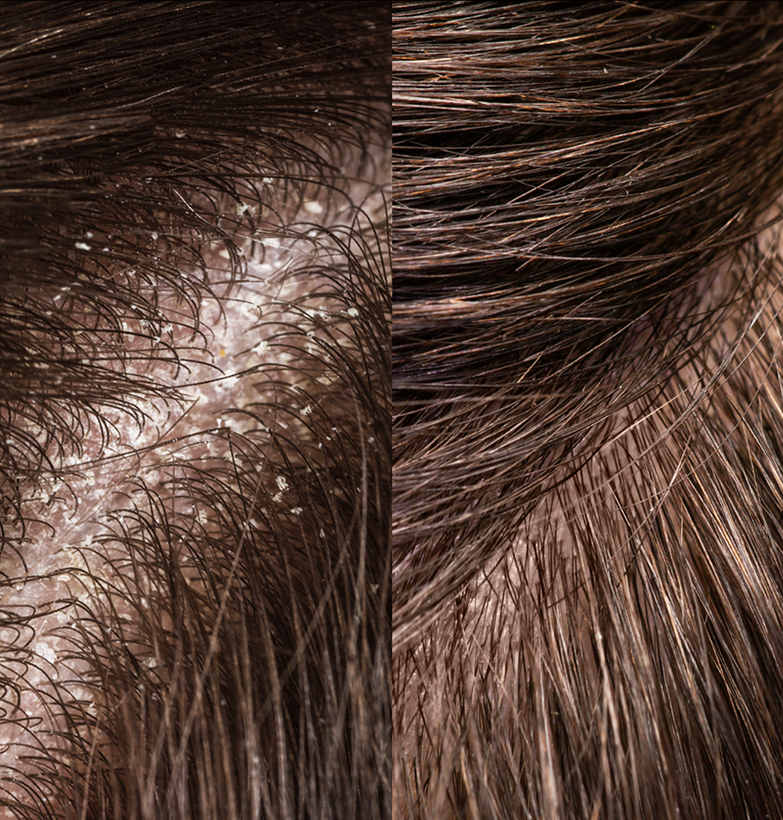 Exfoliating Hair Brush
